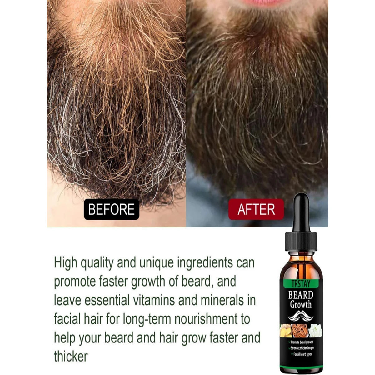 Beard Growth Essential Oil for Men