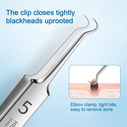 Blackhead Remover Clip & Tweezers Set