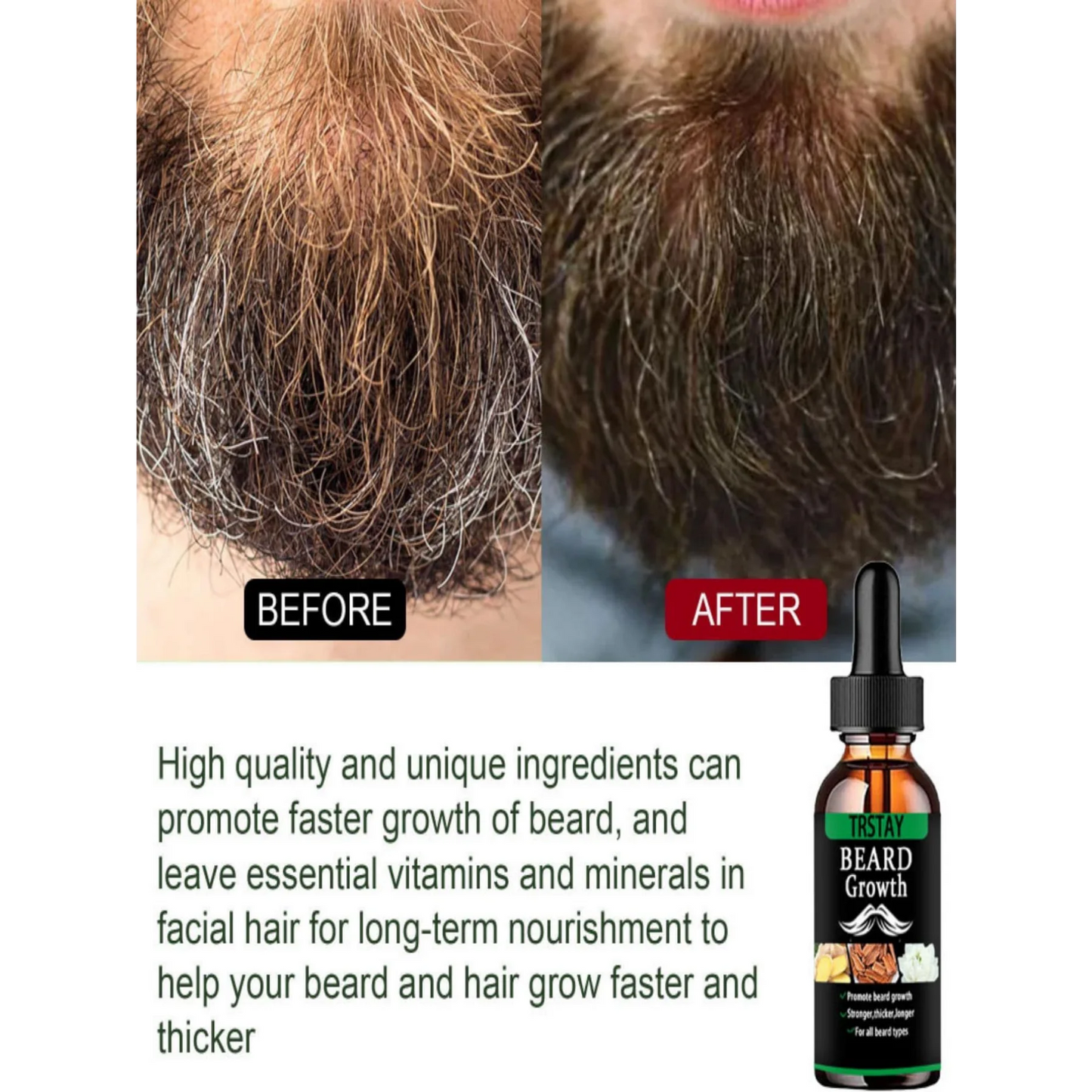 Beard Growth Essential Oil for Men