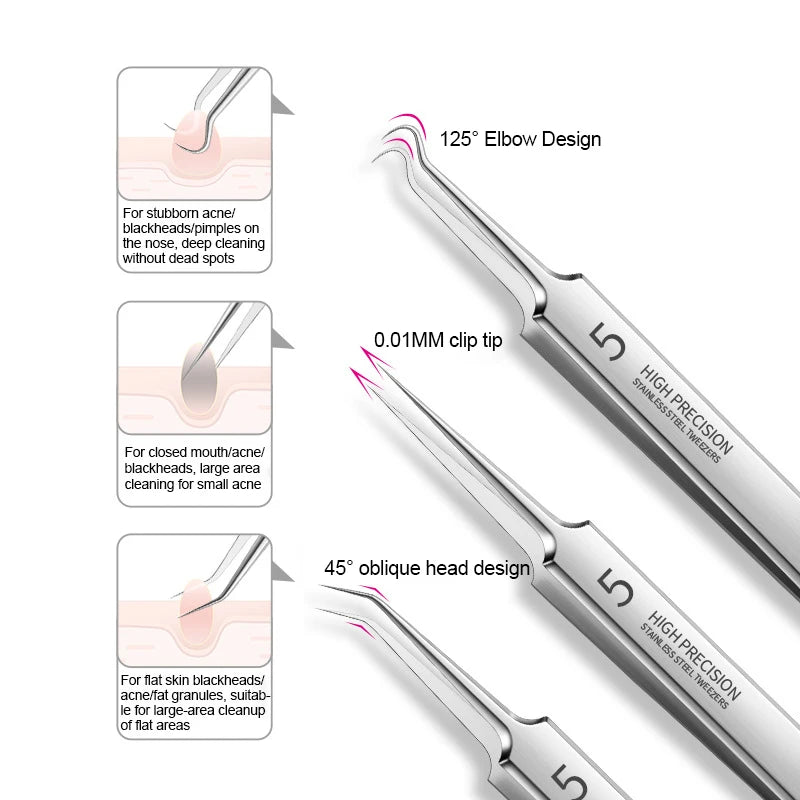 Blackhead Remover Clip & Tweezers Set